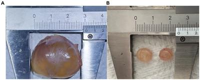 Integrated transcriptomic and metabolomic investigation of the genes and metabolites involved in swine follicular cyst formation